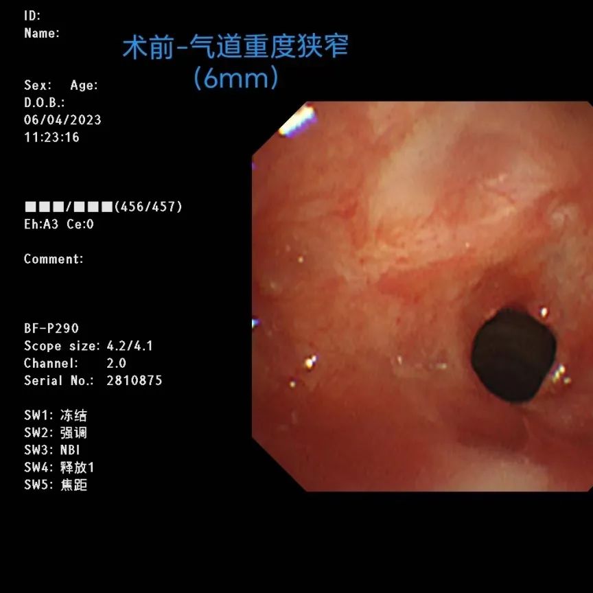 酒后呼吸困难急救,男子误喝消毒水心肺复苏