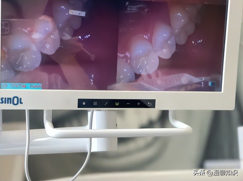 做口腔手术要注意什么,口腔内小手术是什么