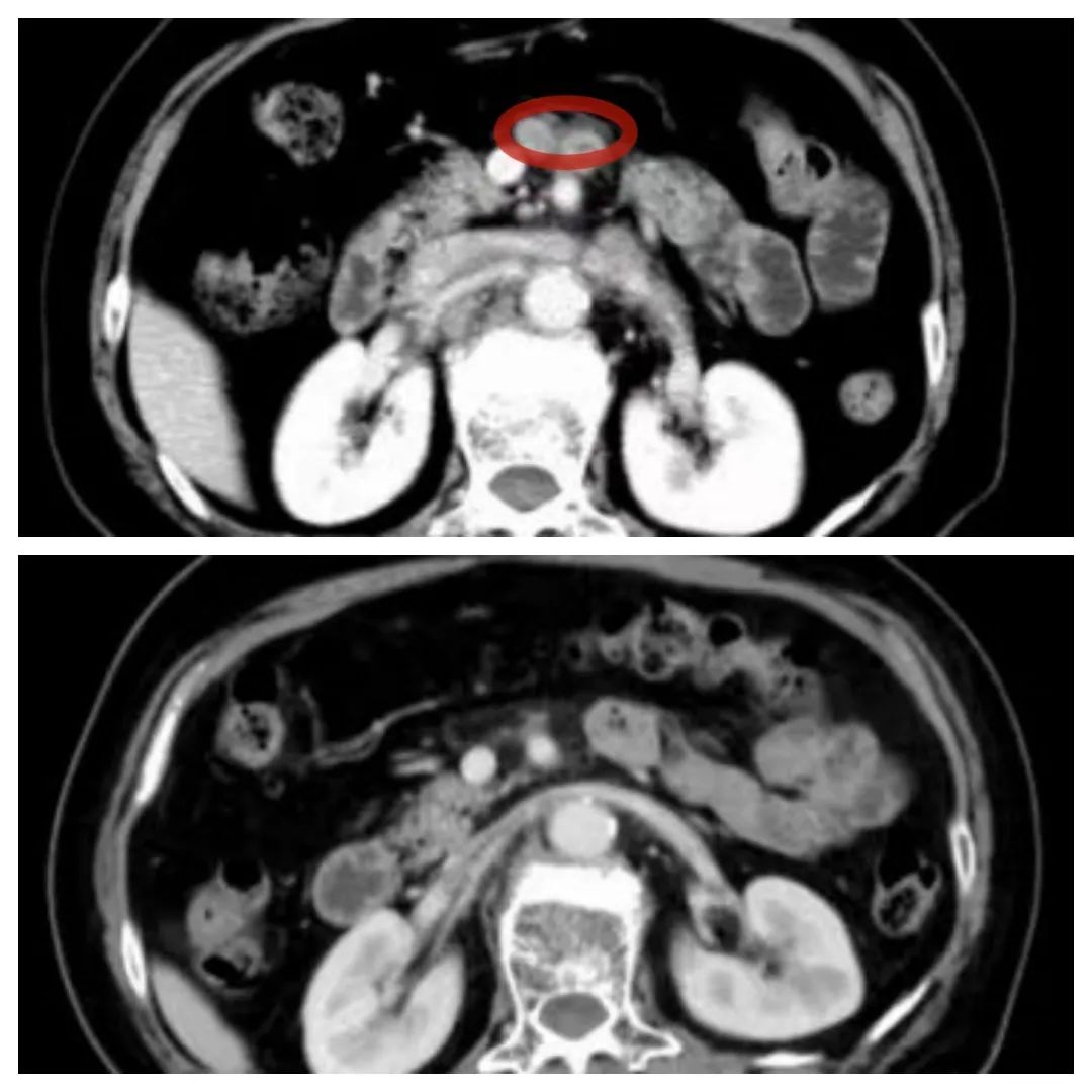 鹰潭184医院能治颈椎病吗,江西鹰潭184医院新进展