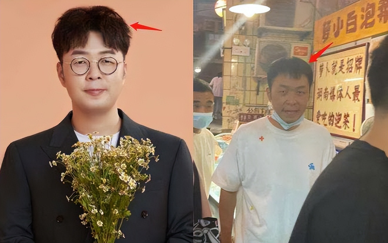 瘦成纸片人的明星,5位纸片人明星瘦成排骨