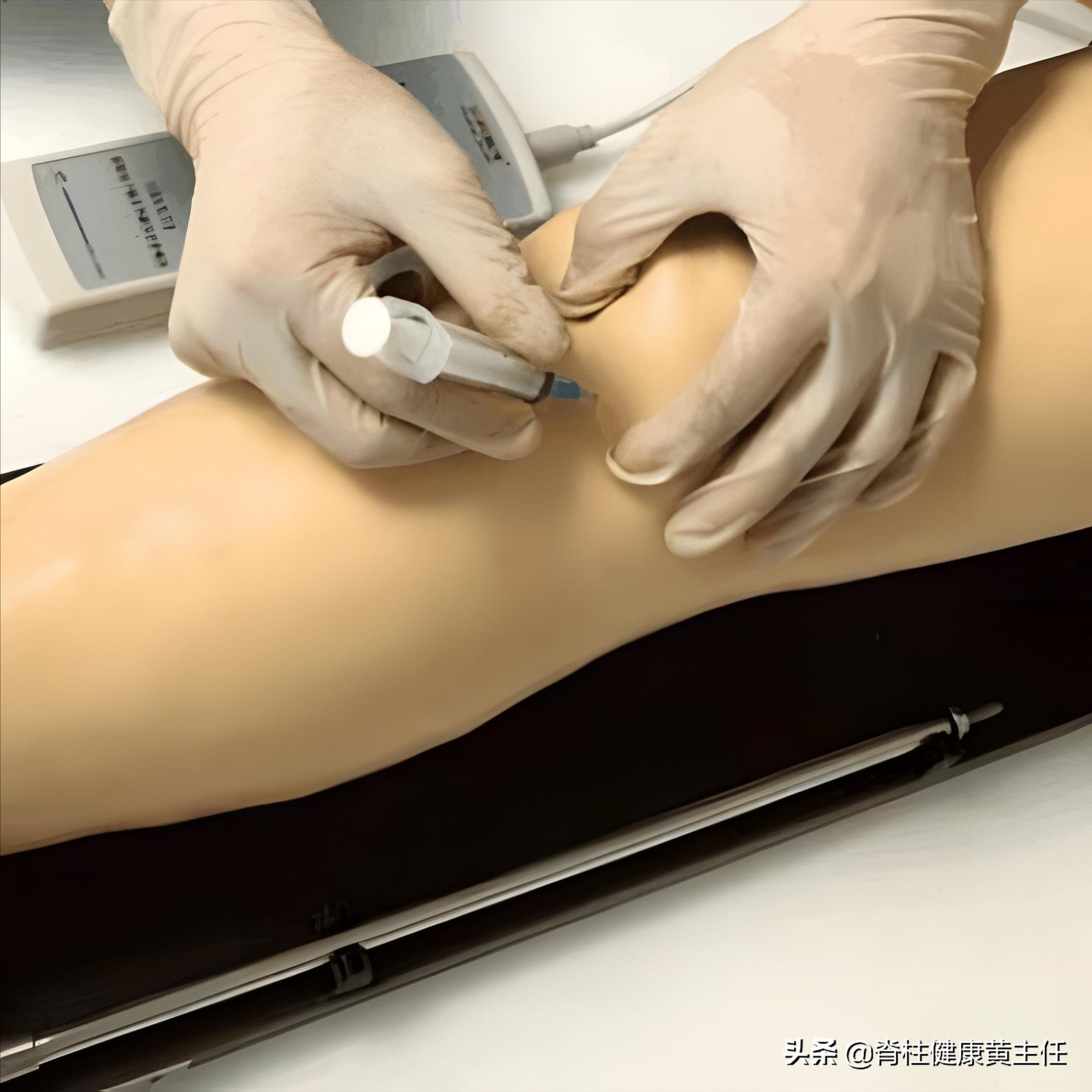 膝关节积液厉害手术会排出积液吗,双膝关节积液右侧腘窝积液