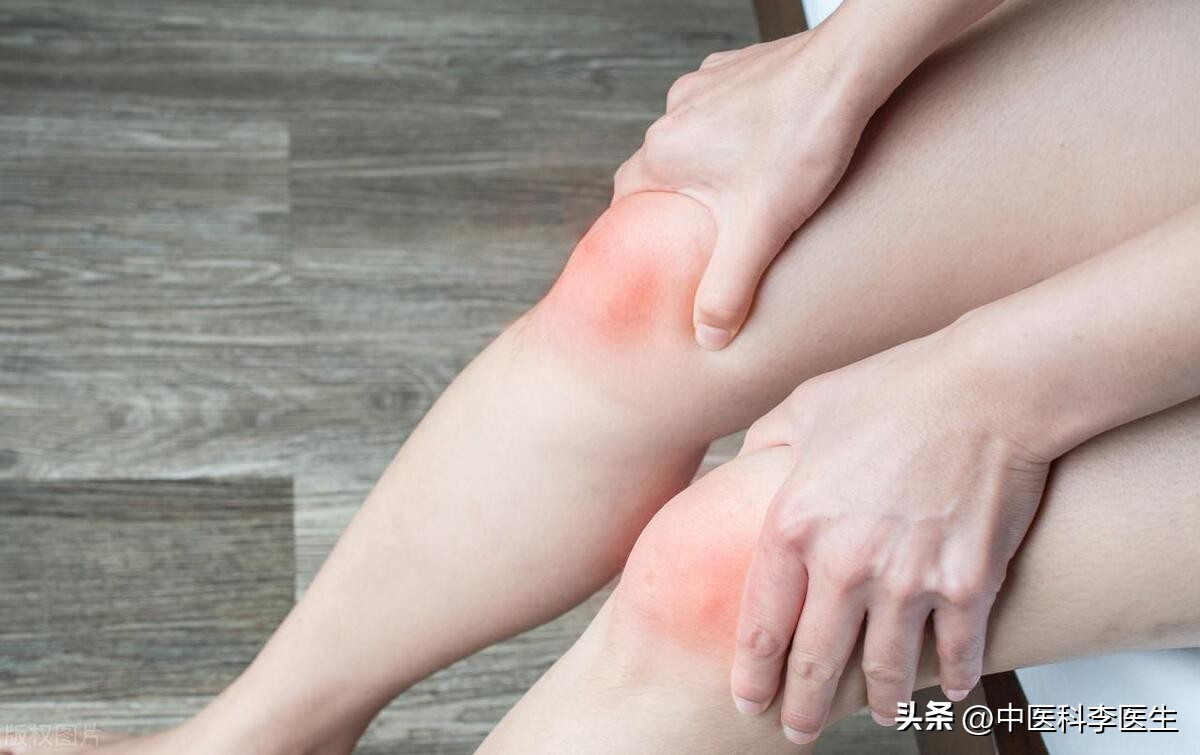 女人膝盖上的淤青怎么弄的,女人膝盖淤青