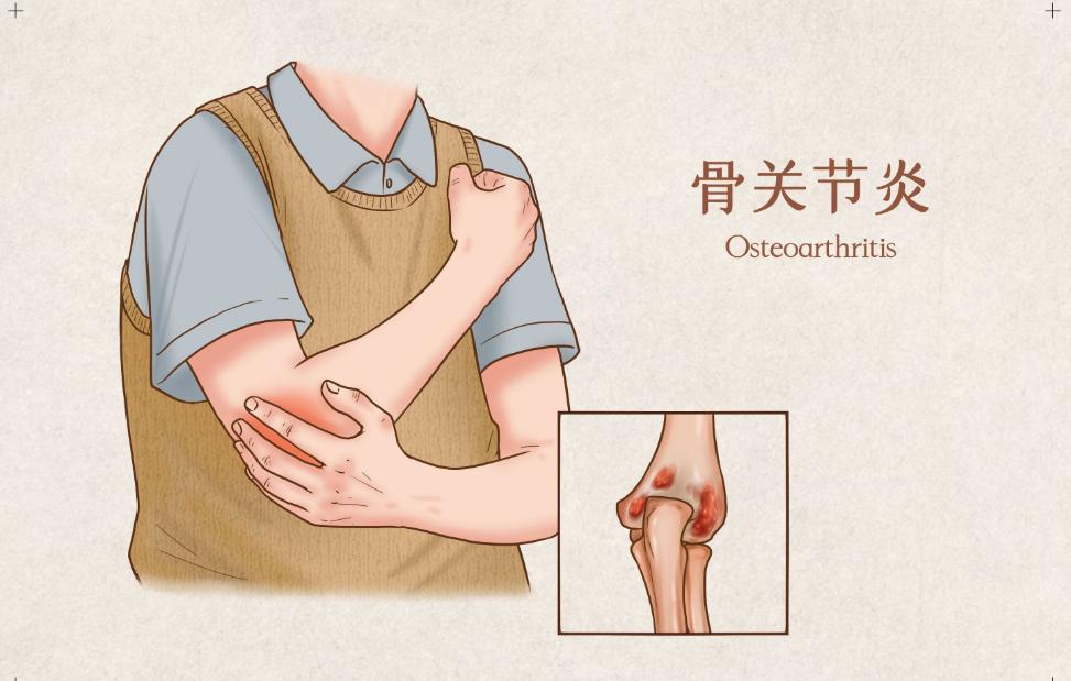 走路时膝盖突然软一下怎么回事,走路时候膝盖突然软一下什么原因