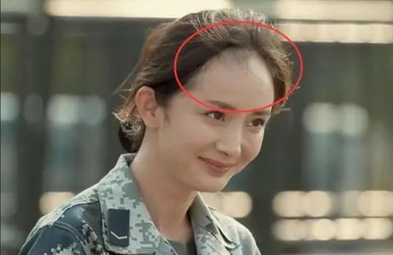 盘点女明星发际线危机,女明星秃头前后对比