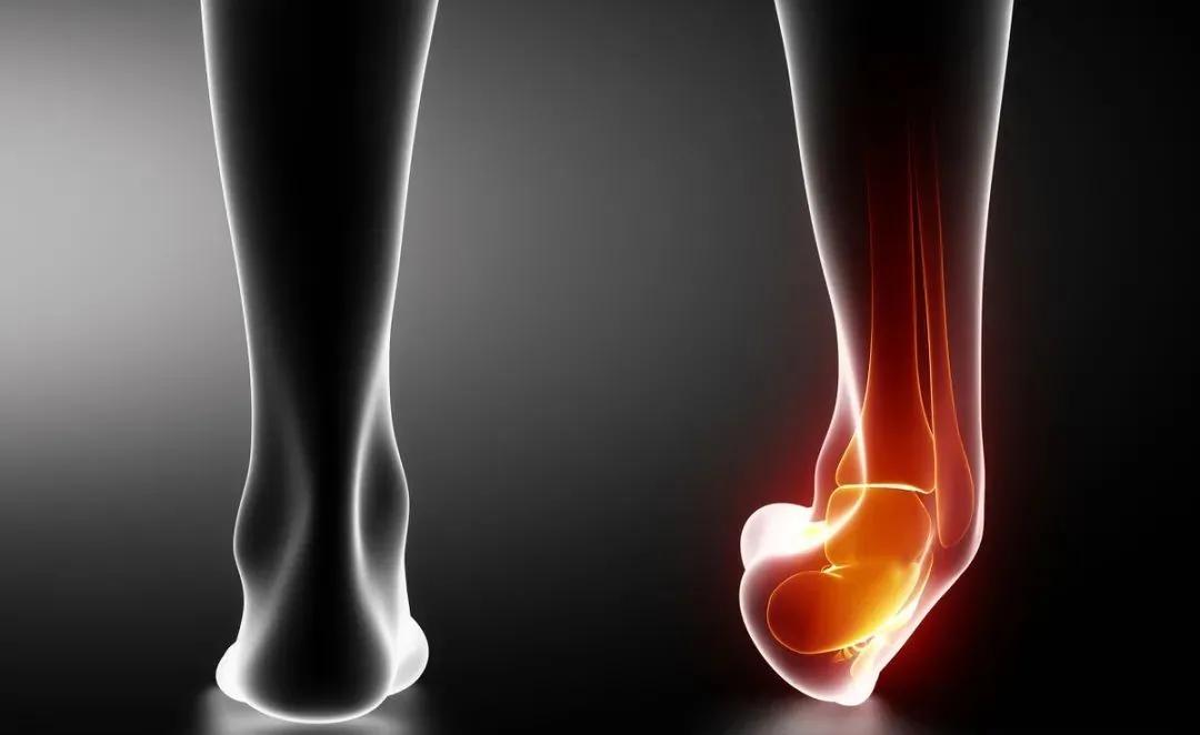 脑梗偏瘫走路脚后跟不着地,脑中风偏瘫患者正常行走步态