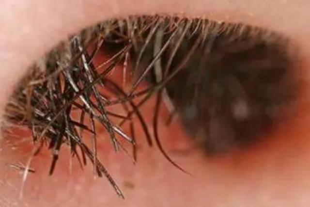 男性头发胡子鼻毛变白是什么原因,37岁鼻毛变白是衰老了吗