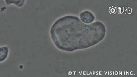 脐带血里存在大量的造血干细胞,脐带血冻存10年
