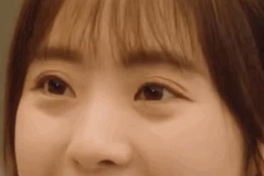 假双眼皮的明星,明星的假脸