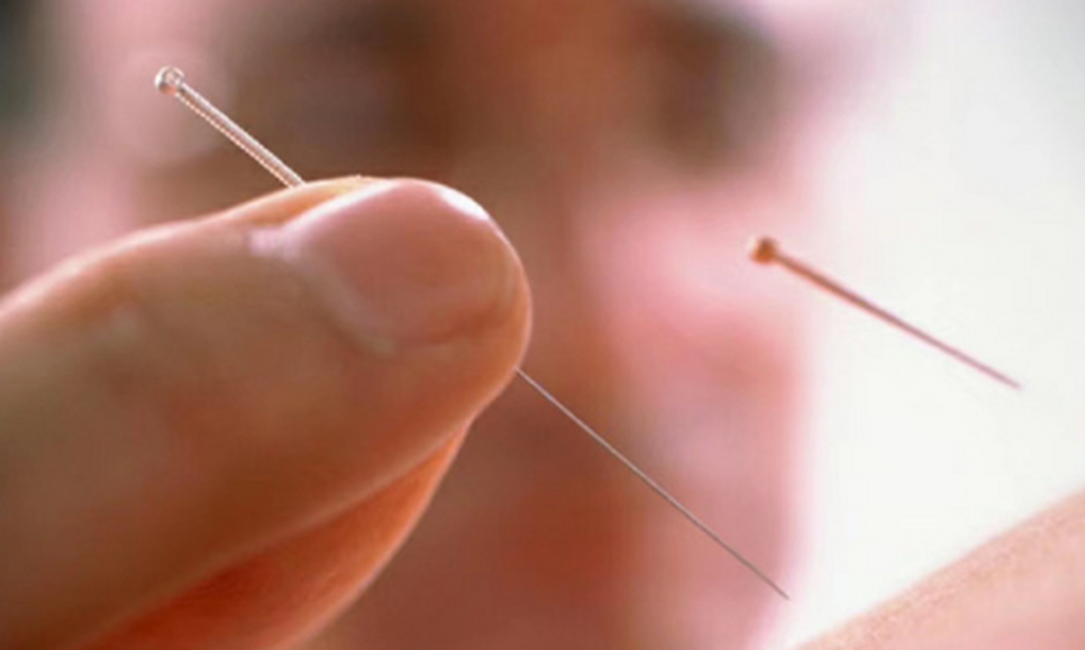 中医针灸治疗腰痛病的学术思想,古法针灸临床治验