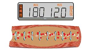 这根血管连通大脑最容易堵!很多人半身不遂后才发现!不看后悔!
