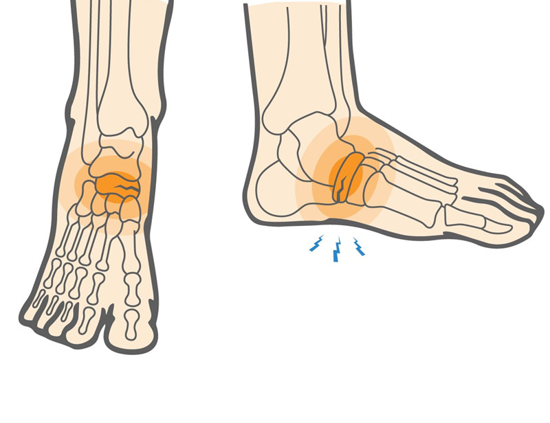 脚背骨质增生疼痛警惕四种病,脚背疼痛是什么原因引起的