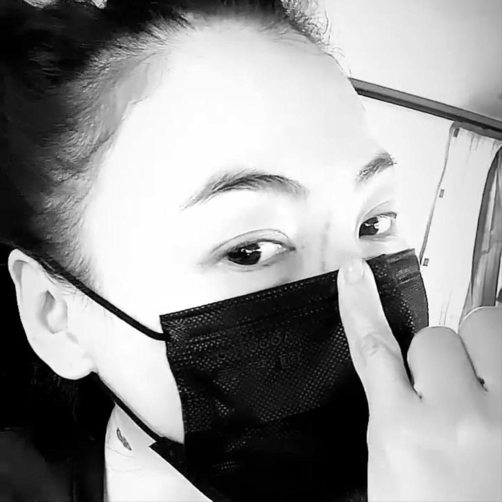 张柏芝被宠物狗咬脸,张柏芝小儿子受伤