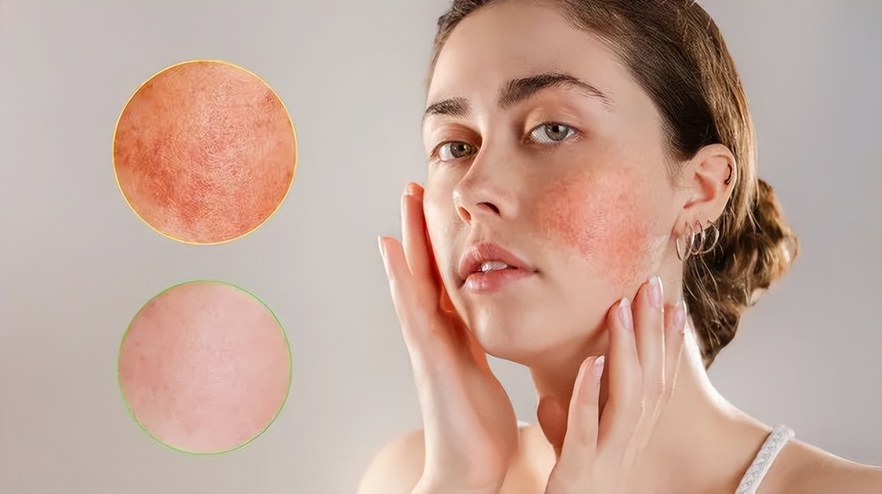 呵护敏感肌用对方法很重要,呵护敏感肌肤