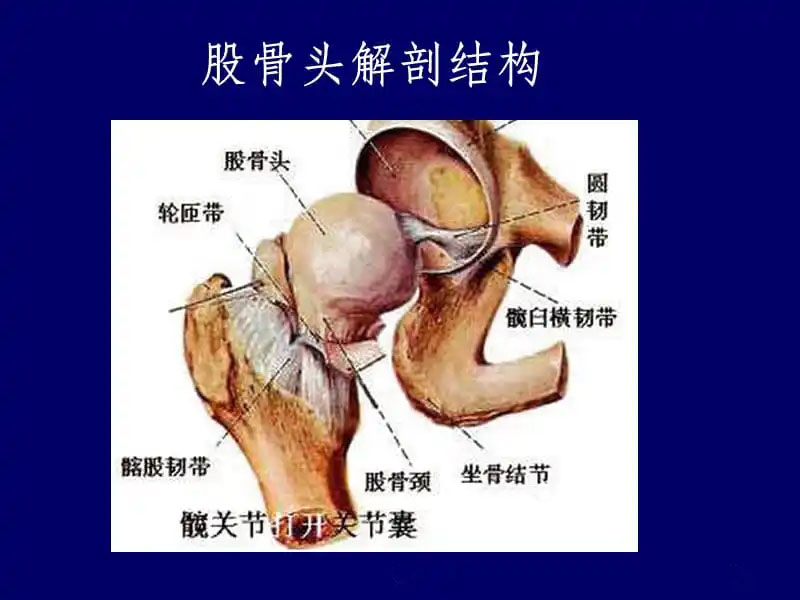 股骨头坏死别怕这样做能少走弯路,股骨头坏死保守治疗能逆转吗