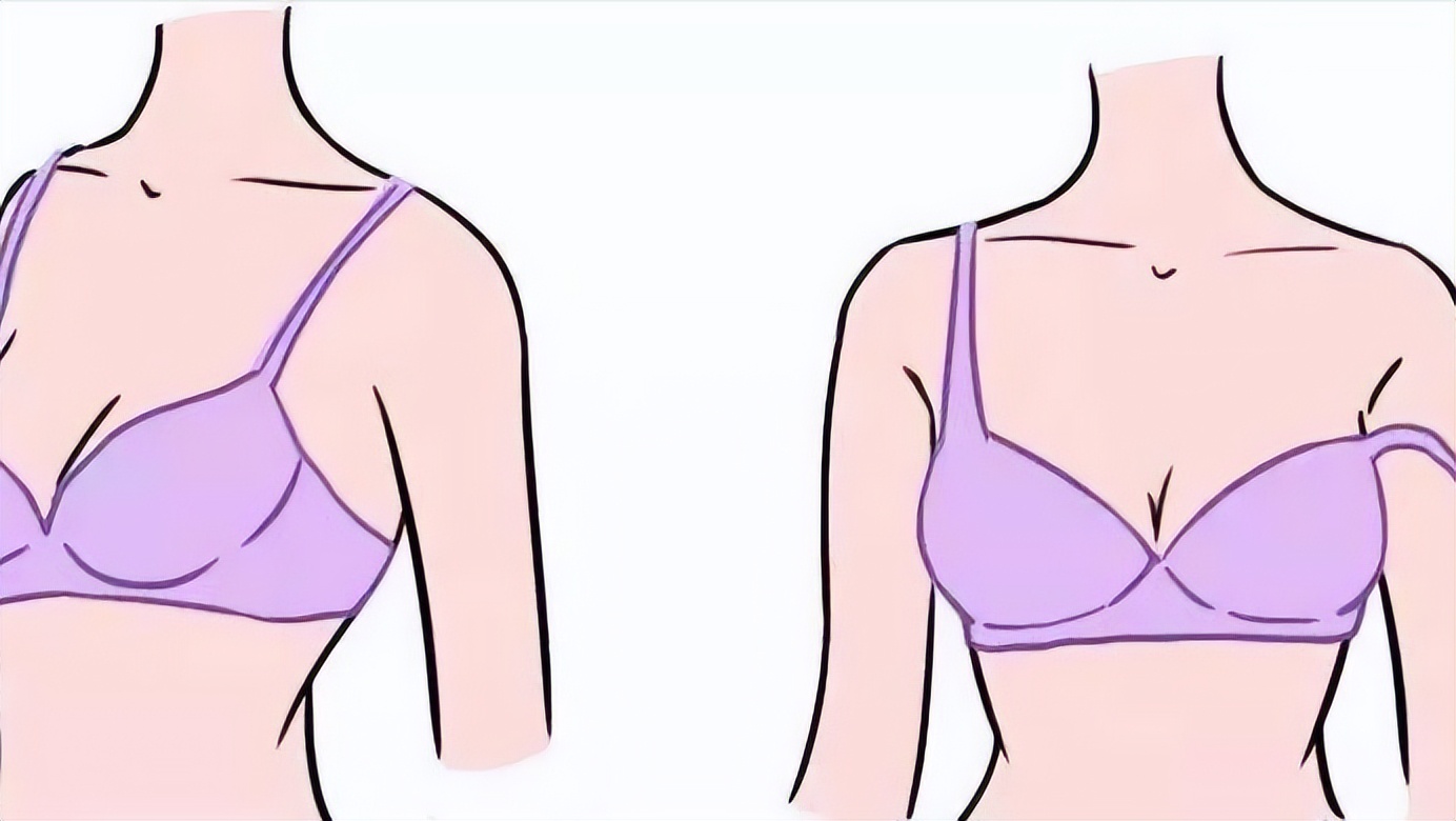 长期穿背心胸罩会导致乳房下垂吗,不经常穿内衣会导致乳房下垂吗