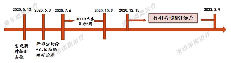 结肠癌术后化疗方案的制定策略,结肠癌手术后热灌注化疗能根治吗