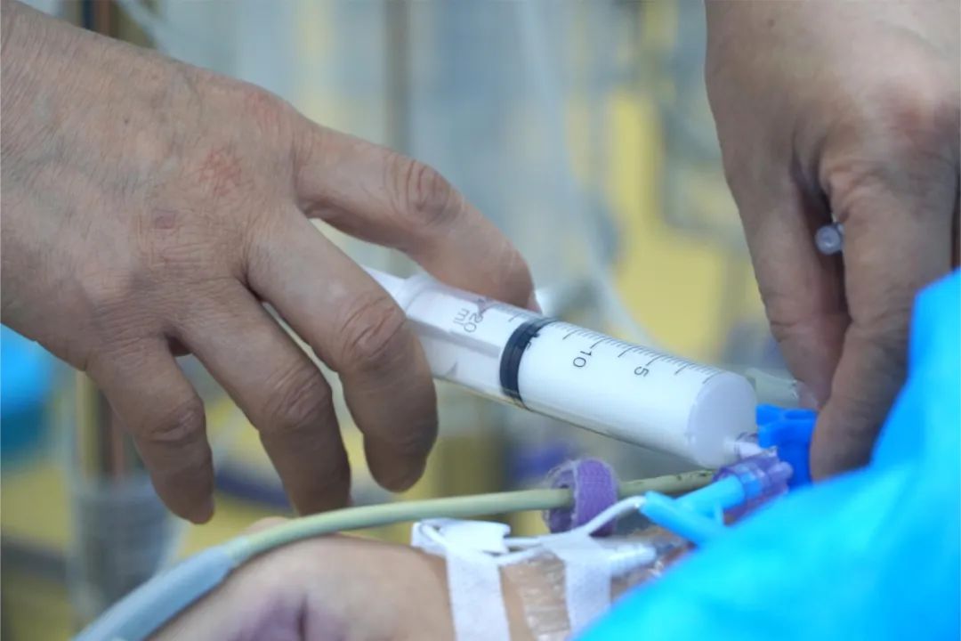 19岁女孩患罕见皮肤病,女子患怪病脸上长着纤维巨瘤