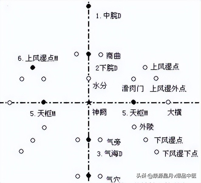 腹针疗法及16例常用处方