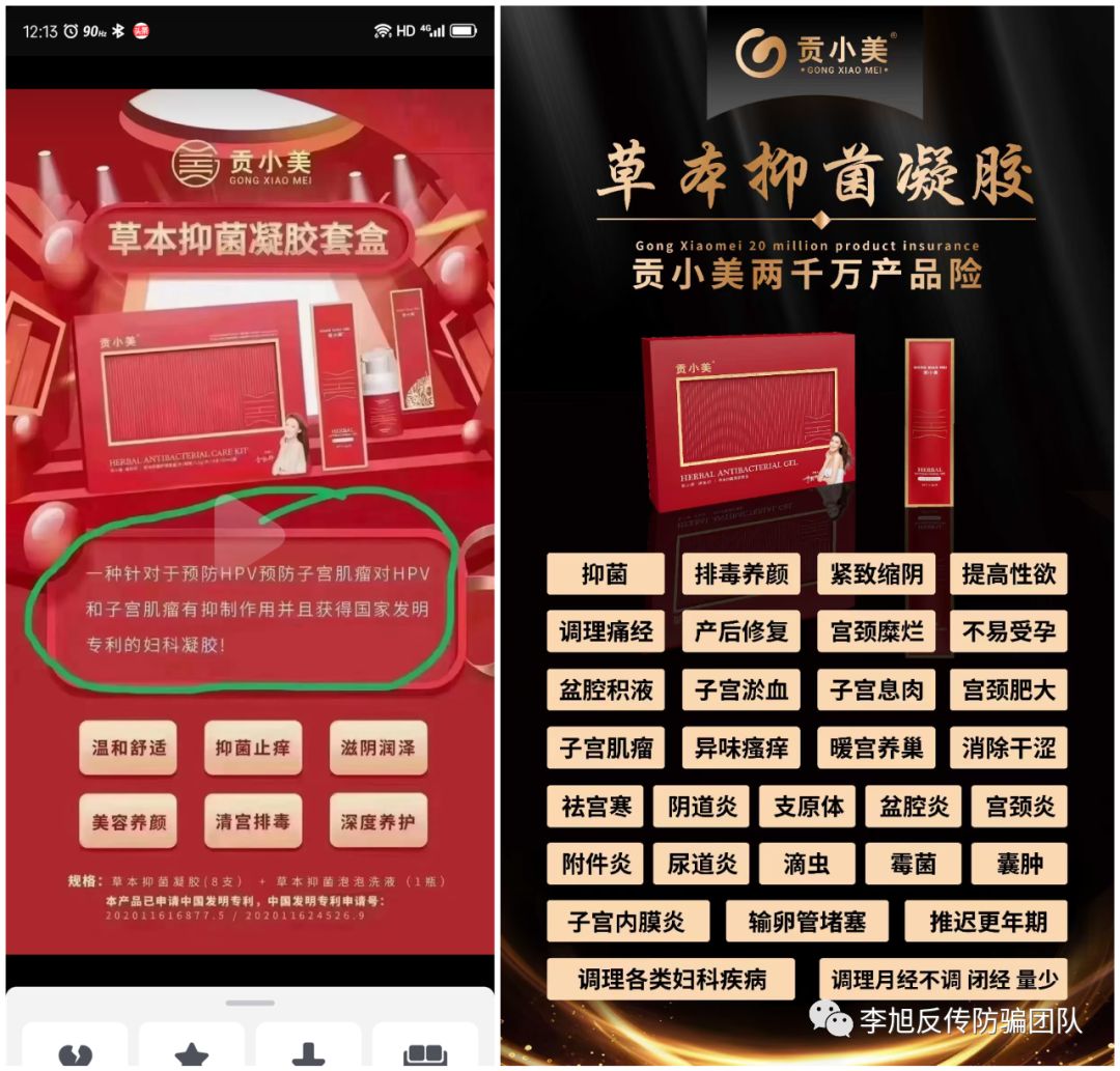 涉嫌传销虚假宣传？自称要做私护行业老大的“贡小美”遭网友质疑