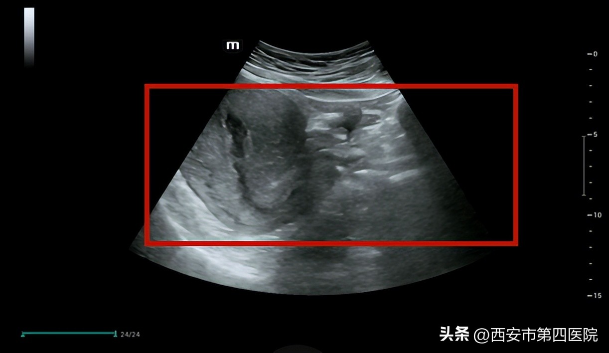 全民素养提升v计划,全民素养提升