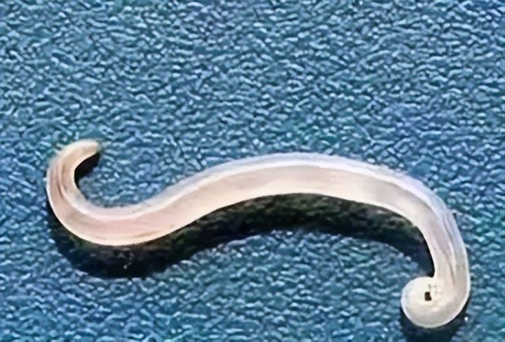 30岁女子半夜屁股痒，肛门竟爬出10多条虫子，医生一看：麻烦大了