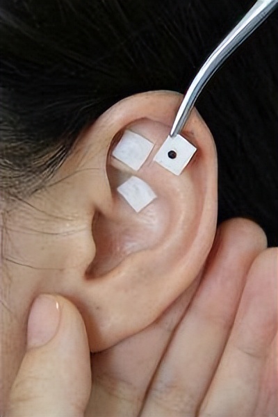 痔疮跟肛周脓肿的区别中医怎么讲,肛周肿痛误为痔疮