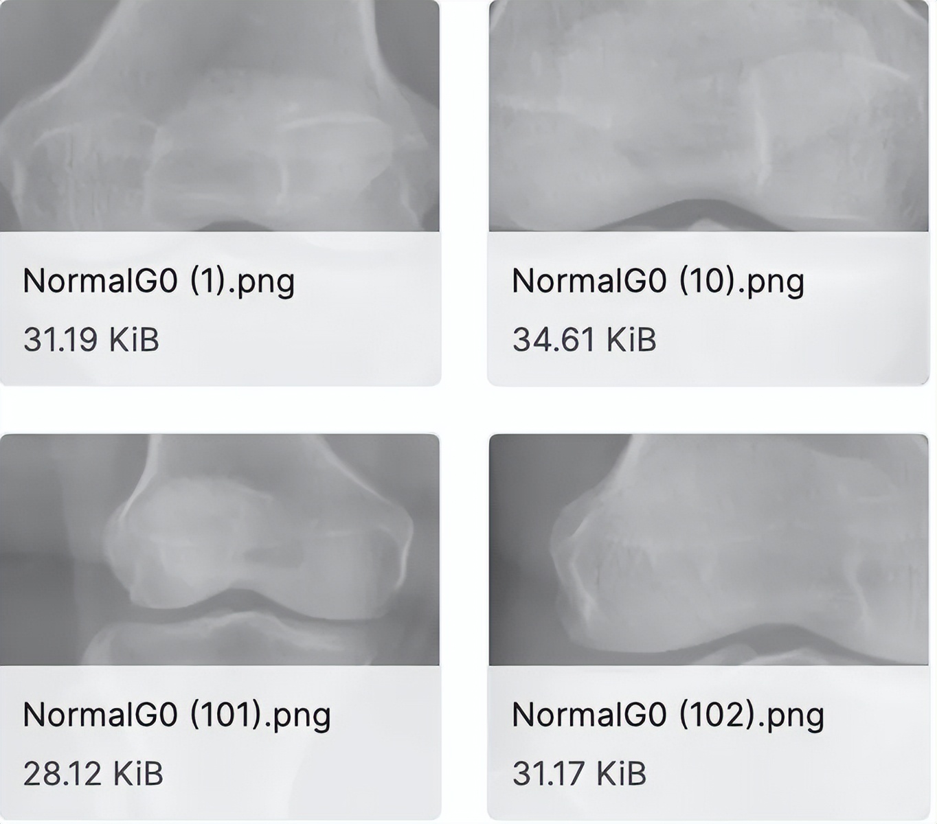 医学影像目标检测框架,开源数据集目标检测