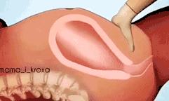 医生把胎盘拿走了,21天胎盘留体内