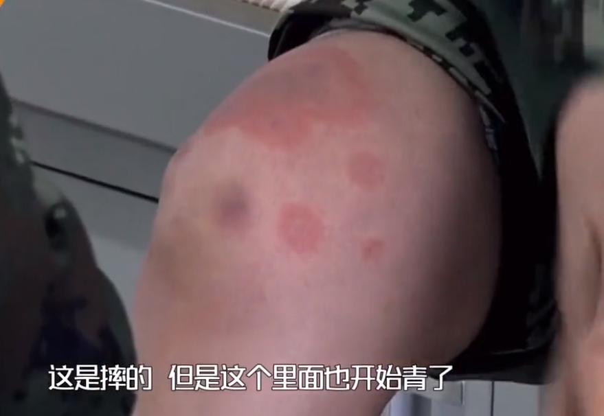 吴卓羲求婚张馨予,张馨予吴卓羲最近消息