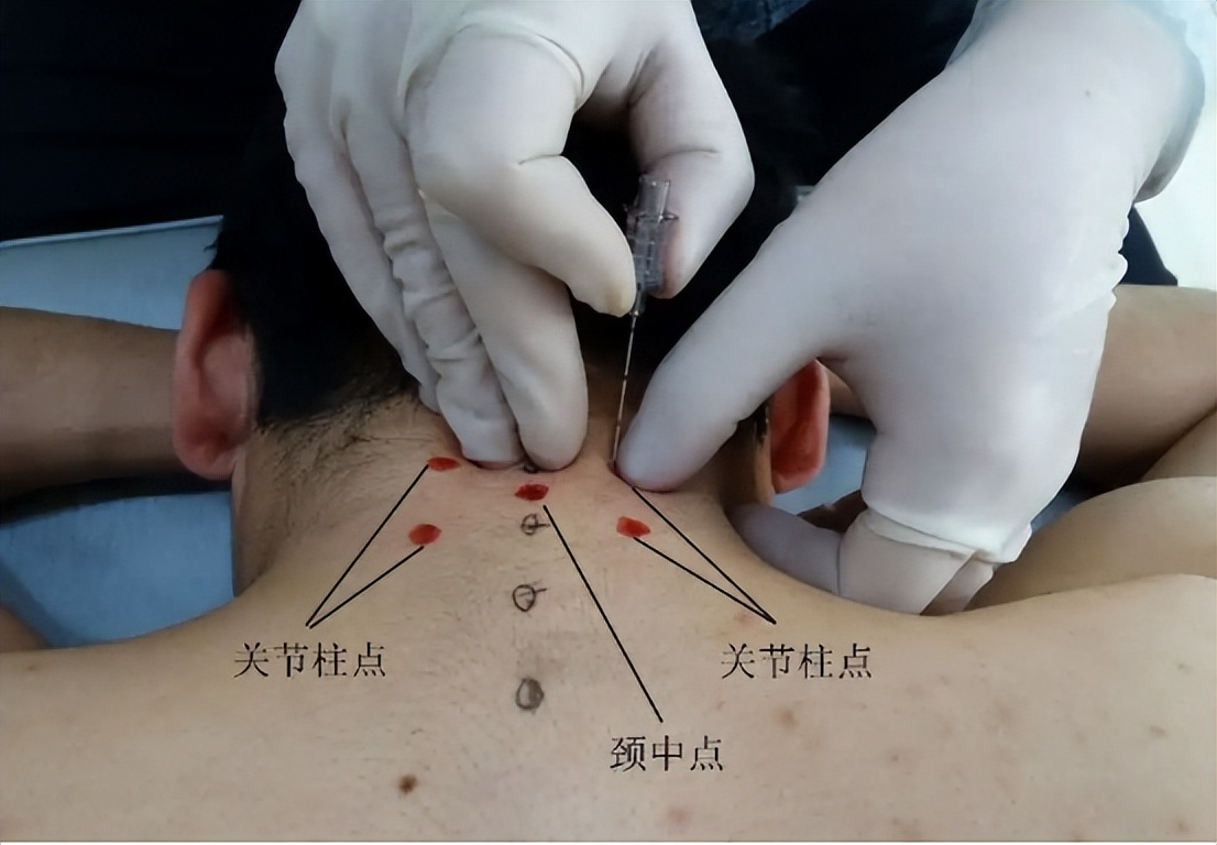 持续性头晕中医能治疗吗,头晕可以要中医调理吗