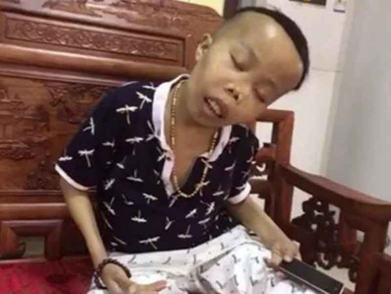 农村娃陈山,最丑网红陈山现状