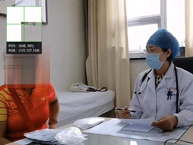 年轻人闭经调理基本都是怎么调理,调理闭经半年的患者