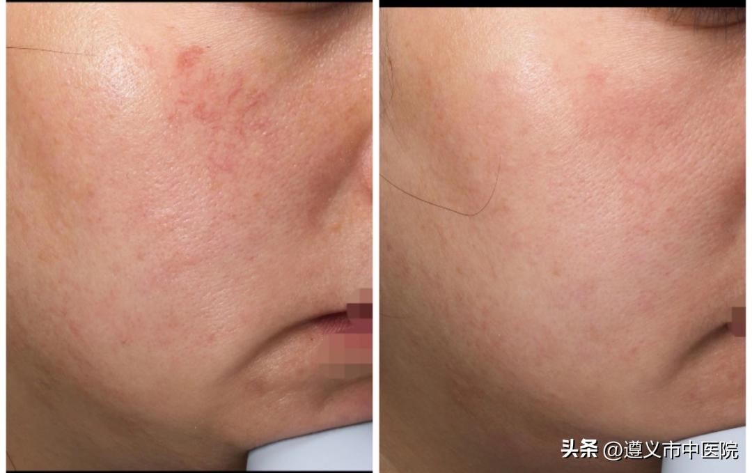 拿什么来拯救你自己,拿什么拯救你电视剧