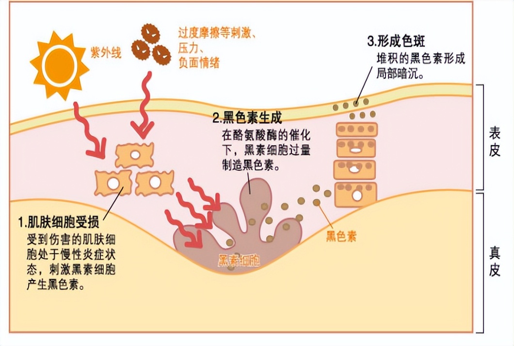 长期照黑光副作用,长期照黄光皮肤会怎么样