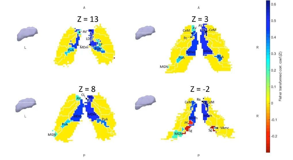 世界帕金森病日第28个主题,世界帕金森病日完整版