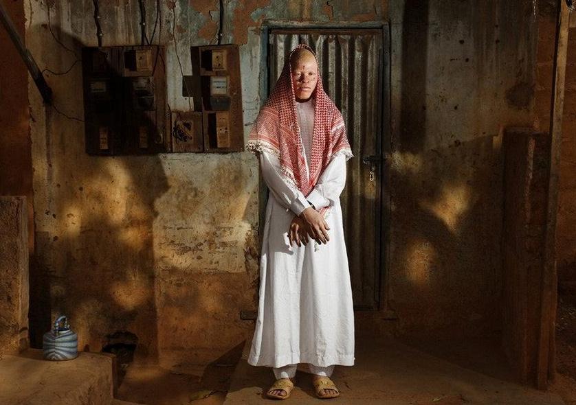 非洲版“唐僧”：血液堪比黄金遗骸可卖上百万，警方束手无策