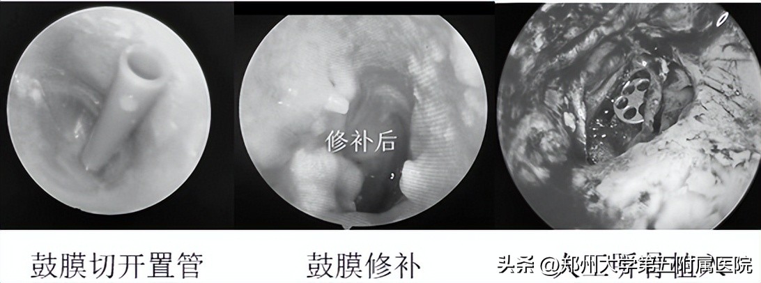 全国爱耳日护耳小知识有哪些,全国爱耳日预防知识