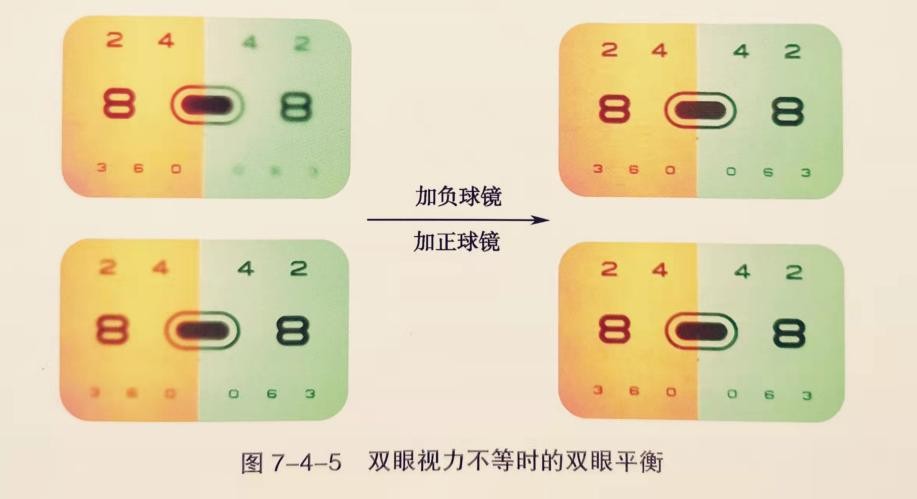 去医院做验光流程,眼镜配镜标准流程表