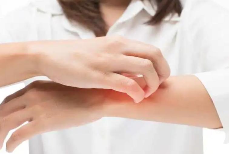 3块钱一瓶的炉甘石洗剂，连世卫组织都推荐，能用它来治哪些病？