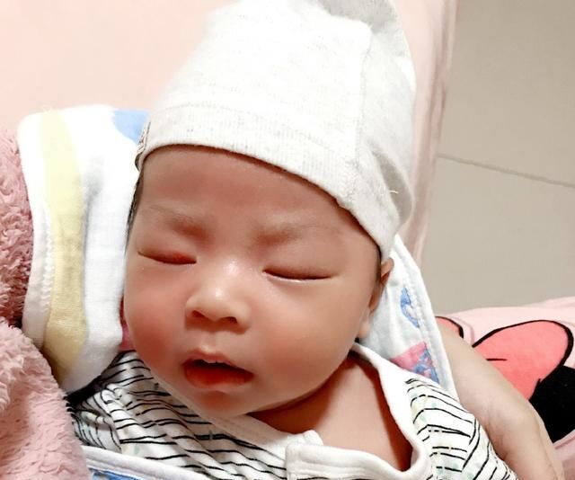 为什么新生儿都是单眼皮,新生儿出生是单眼皮会变双眼皮吗