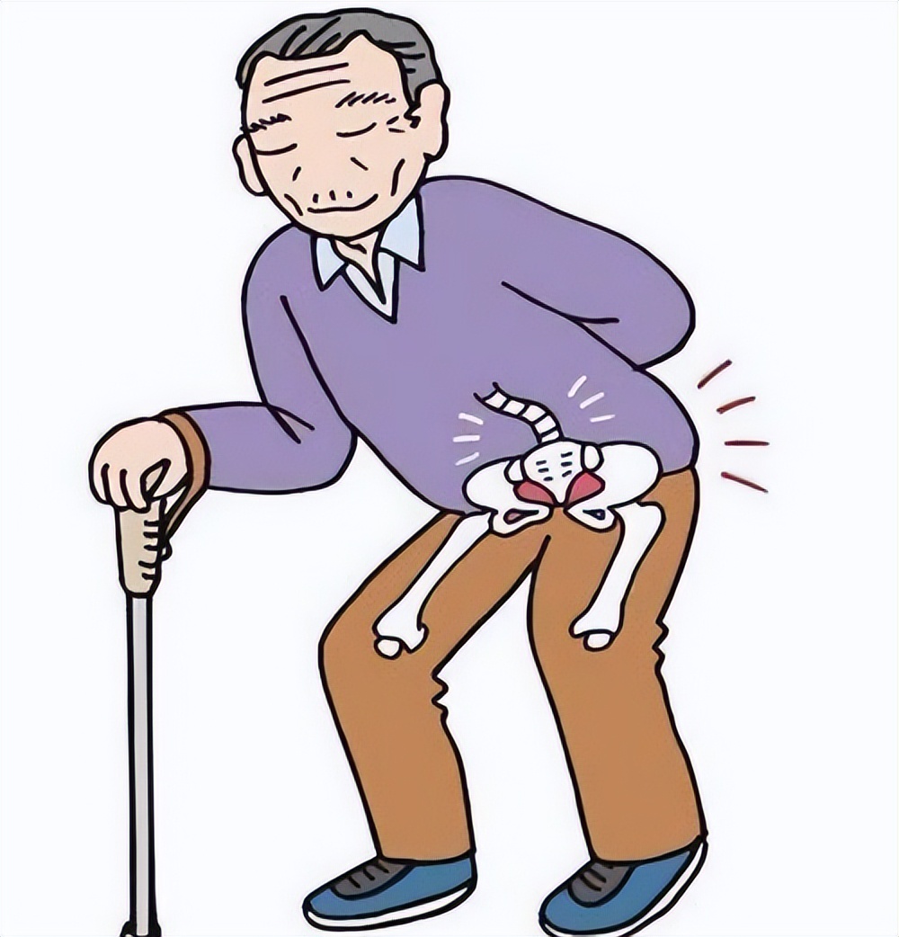 马尔尼菲篮状菌病诊断又出新指标,马尔尼菲篮状菌病皮损呈多形性