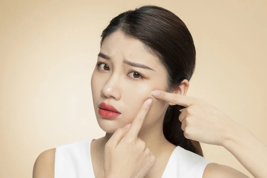 额头有痘痘可以敷补水面膜吗,长痘痘可以敷面膜用精华吗