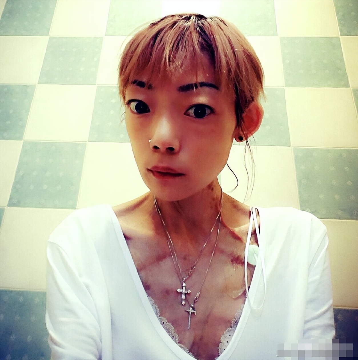 “最惨阔太”伍智恒：嫁豪门8年，换来牙齿全脱，体重仅剩44斤