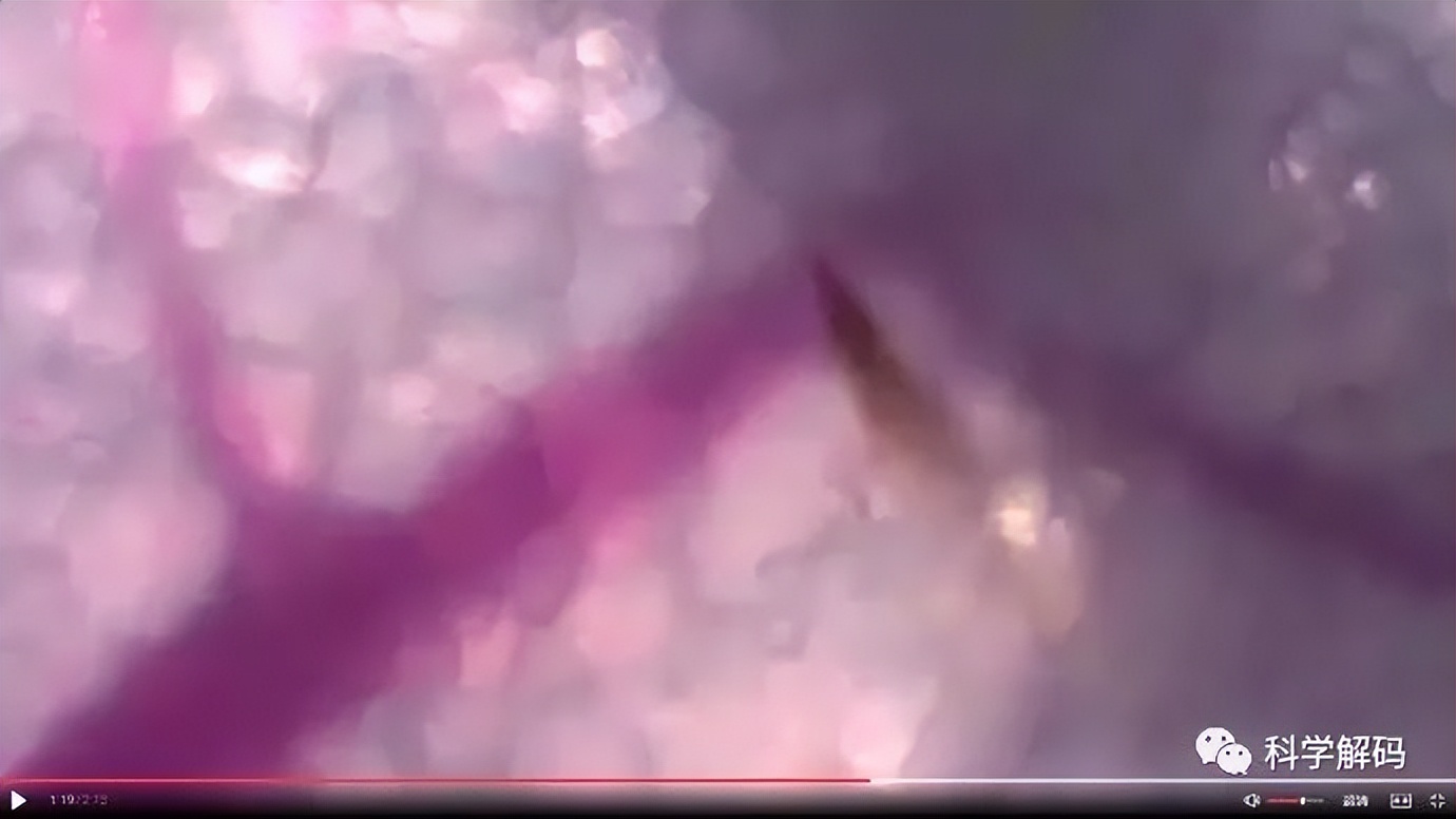 蚊子的嘴解剖,蚊子的内脏解剖照片