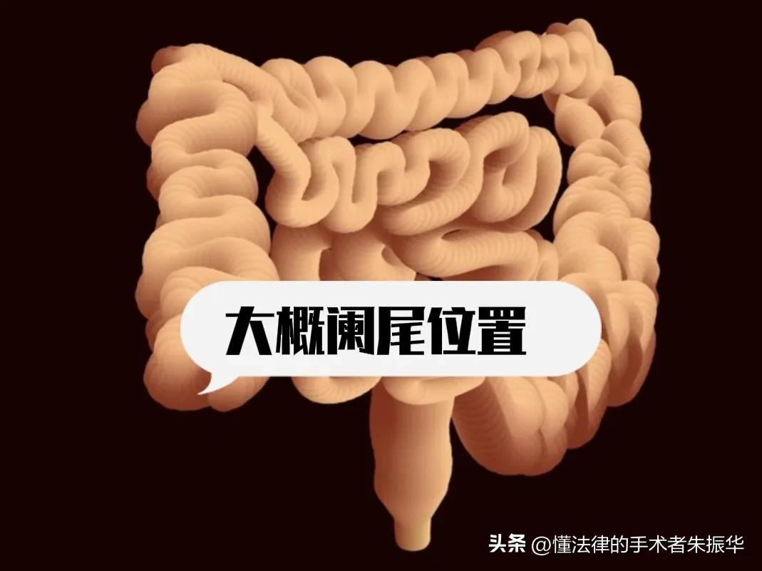 手术后出血一定要谨慎处理