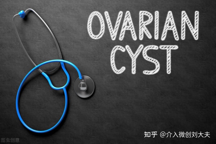 CT引导下介入硬化治疗卵巢巧克力囊肿临床研究招募