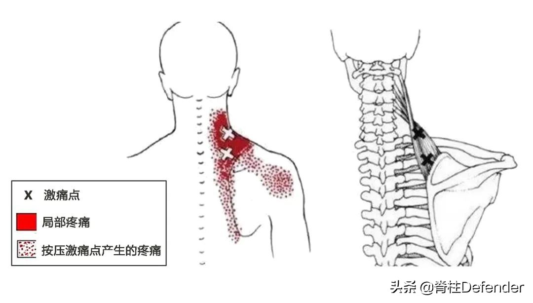 脖子肩膀酸痛的有效缓解方法,最近脖子两侧颈肩酸痛