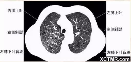 胸腹部盆腔ct主要检查什么,女性盆腔ct断层解剖结构图