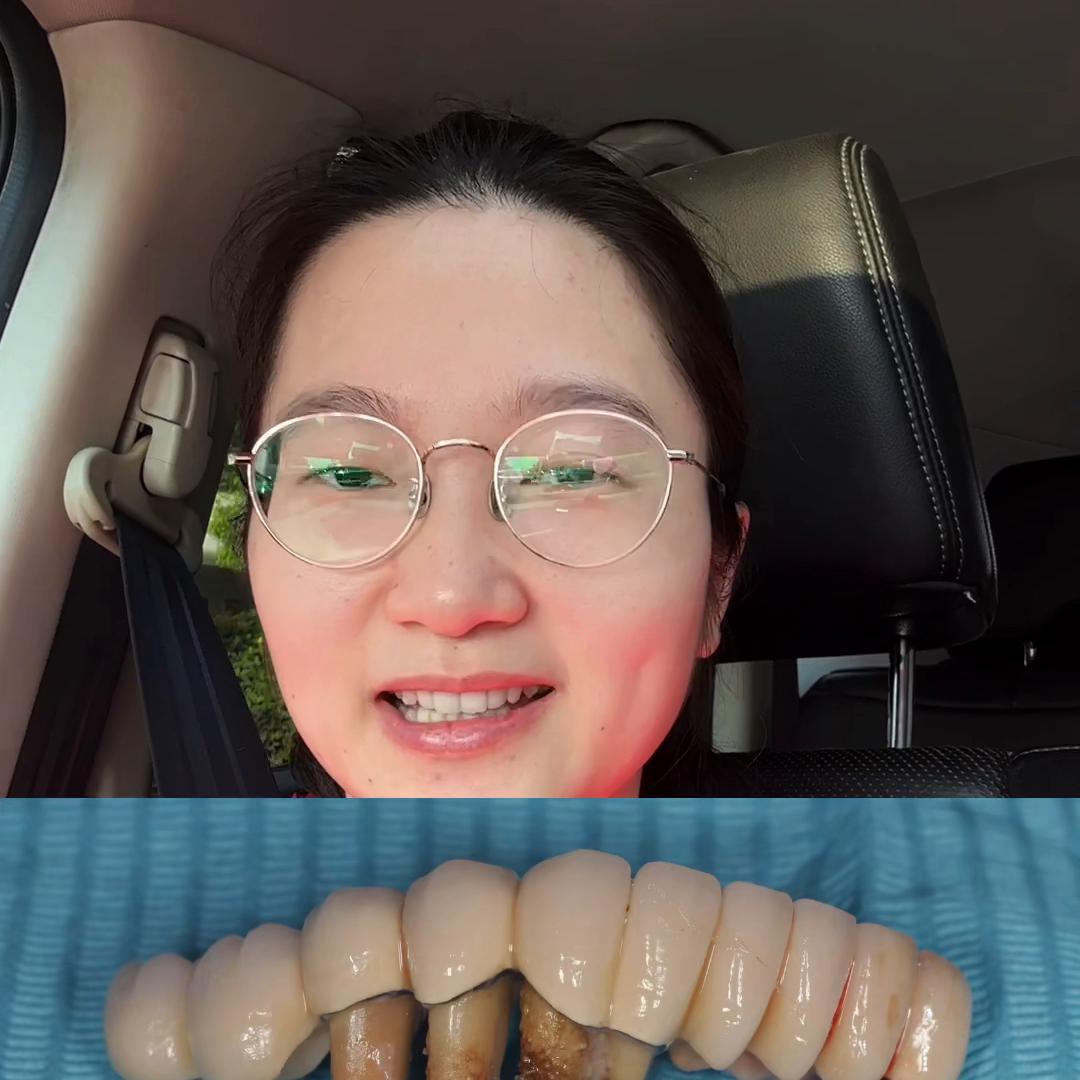 口腔修复金属桥,口腔修复学关于固定桥的问题