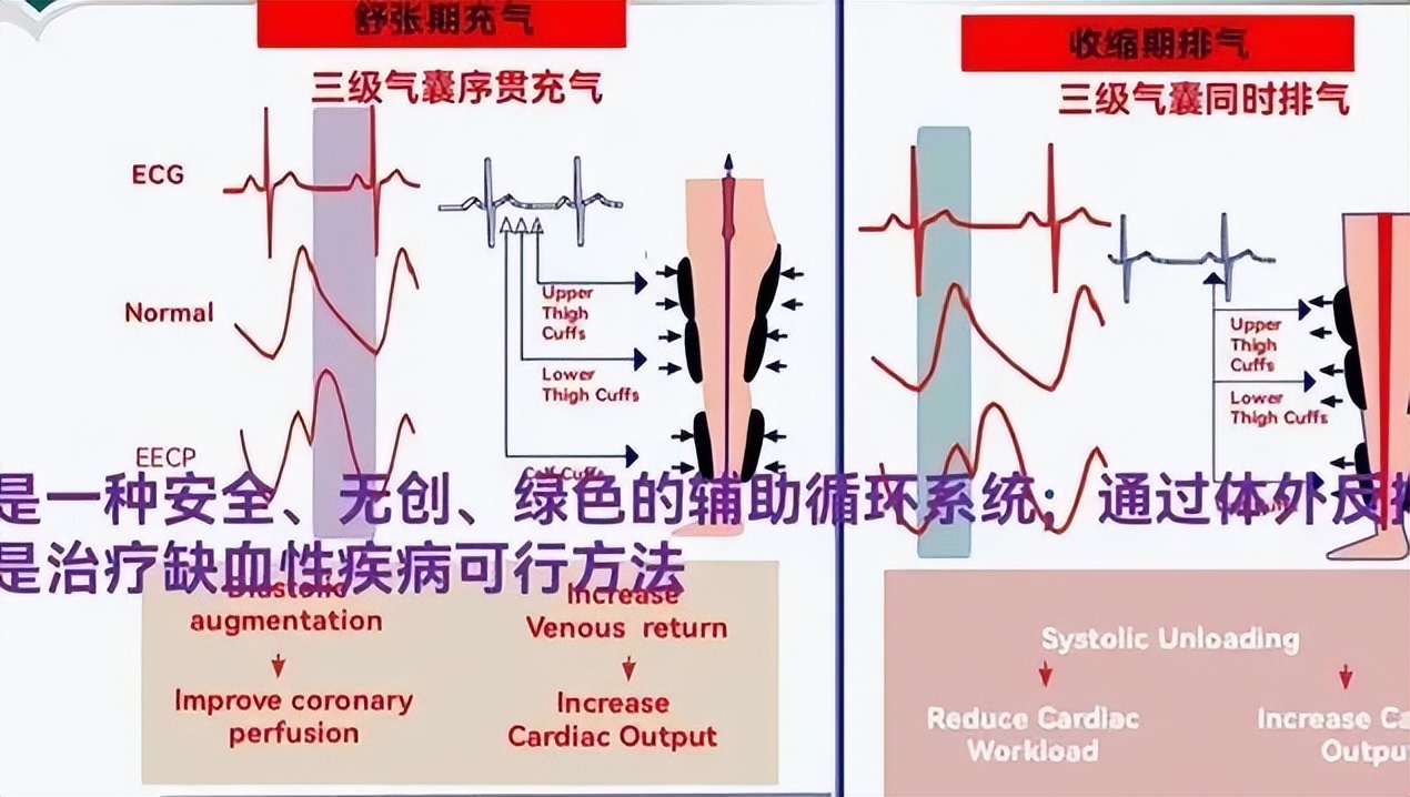 守护心脏,守卫者心脏治疗仪